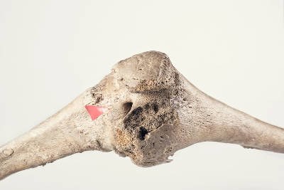 Anatomická sbírka
