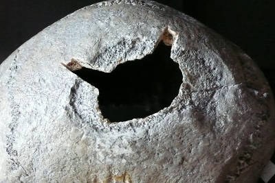 Trephinated skull collection